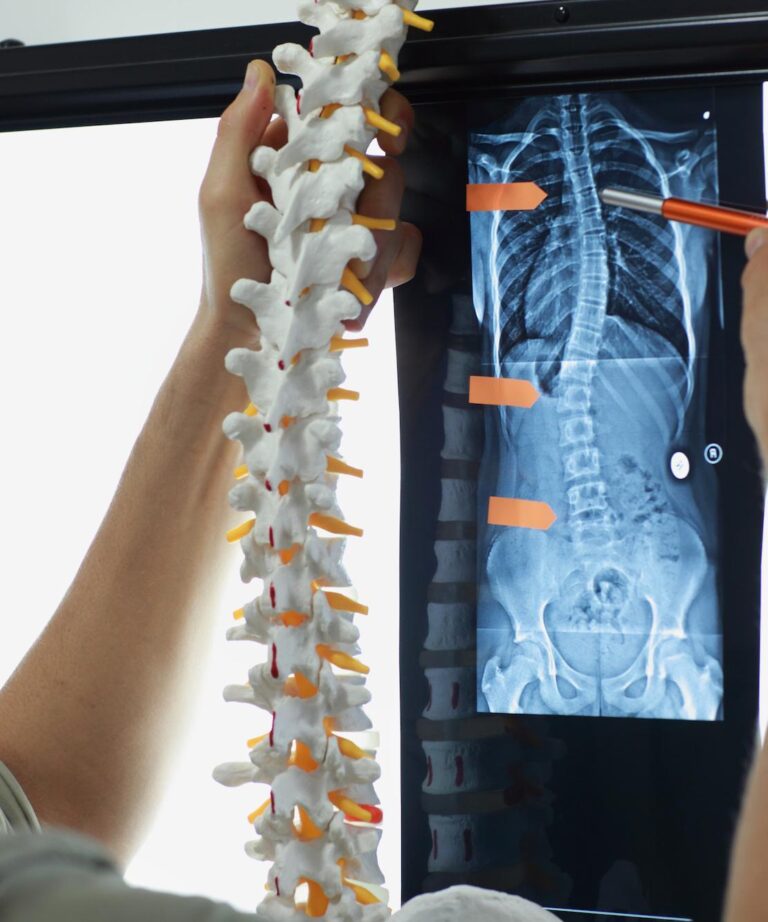   Trusted Spine Doctor Near You for Pain Relief  Your Path to a Pain Free Future